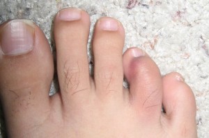 toes1