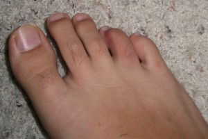 toes2
